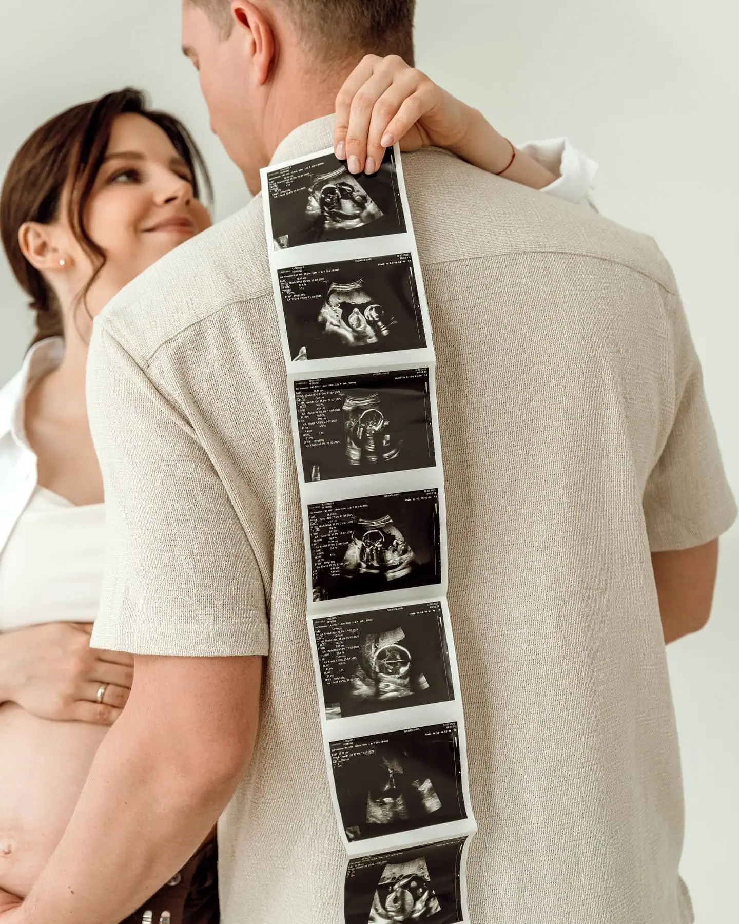 wbs partner pregnancy photoshoot ideas